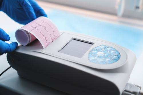 Electrocardiograma en CDMX